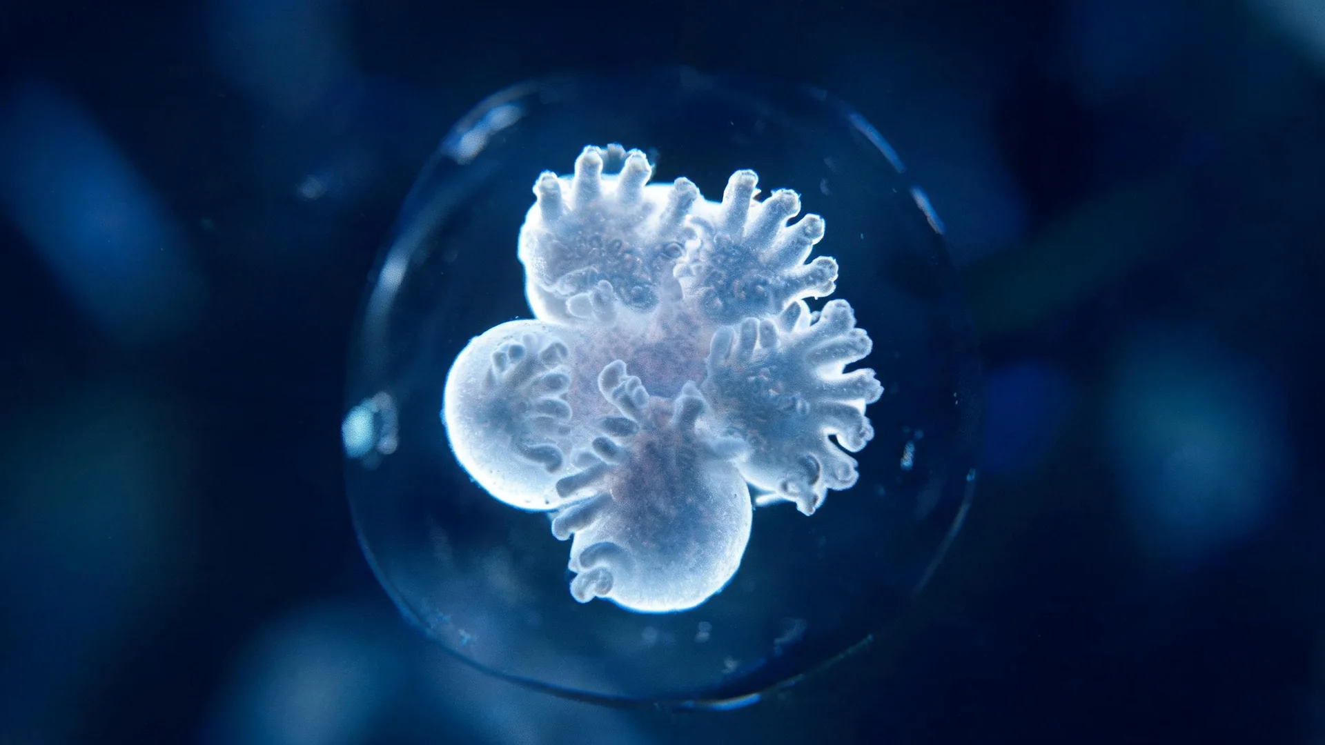 An intestinal organoid viewed through a laboratory microscope.